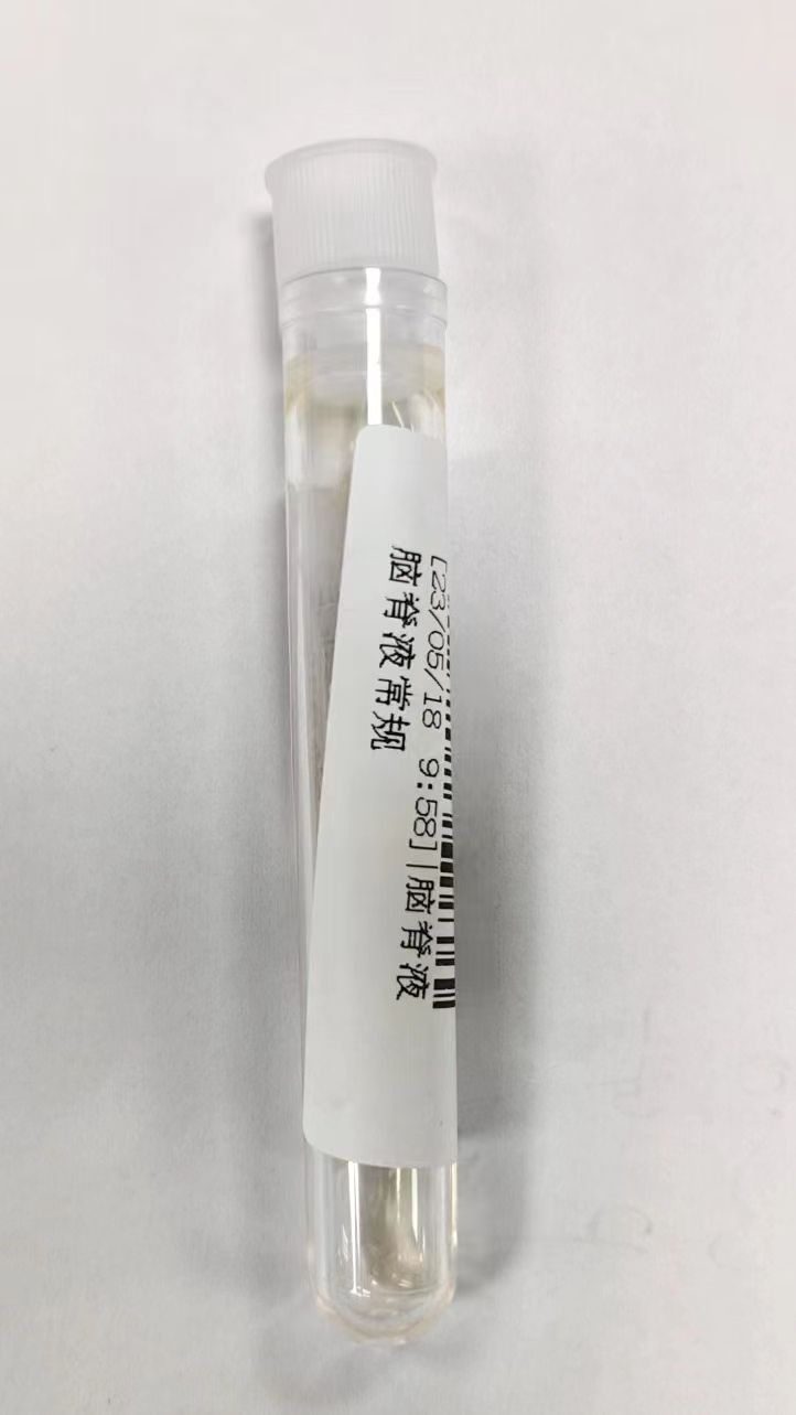 脑脊液生化